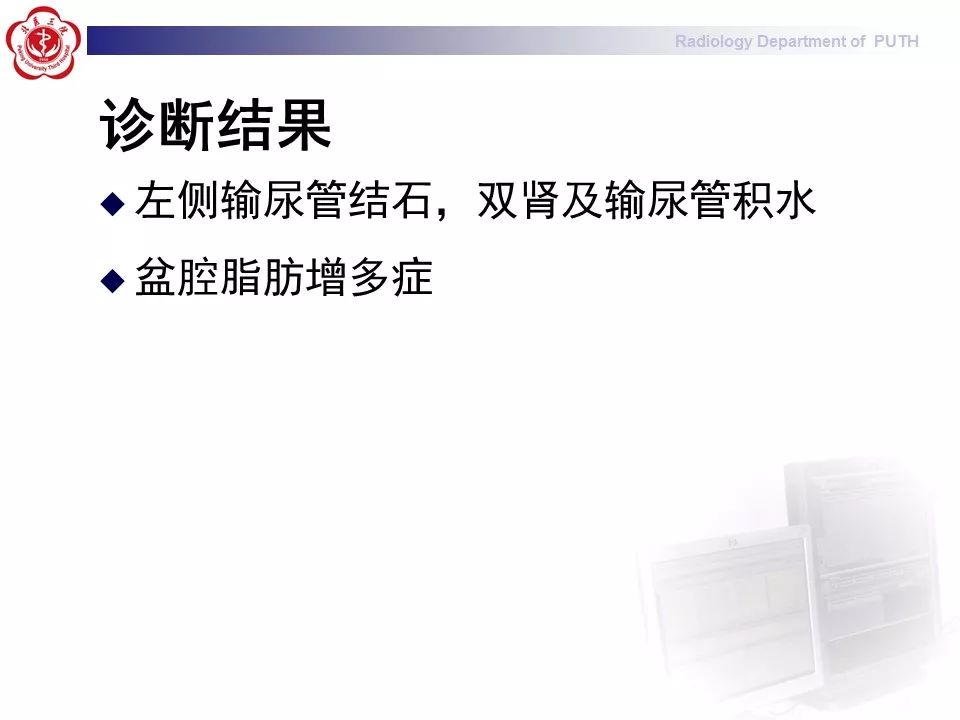 【病例】盆腔脂肪增多症1例CT影像表现