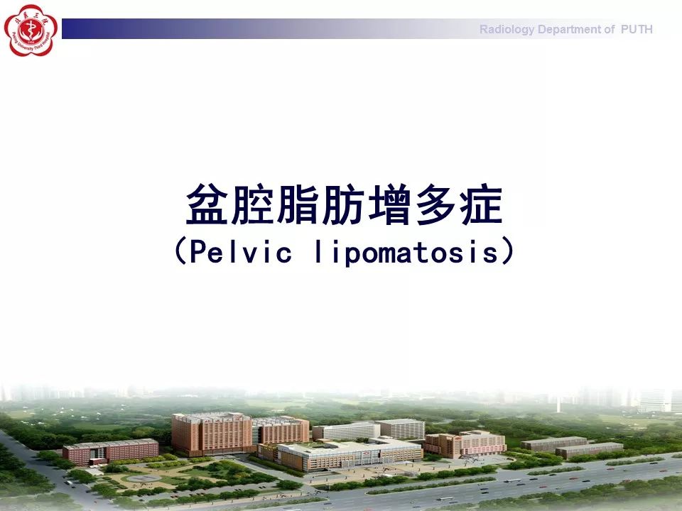 【病例】盆腔脂肪增多症1例CT影像表现