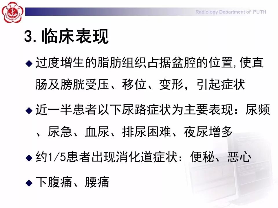 【病例】盆腔脂肪增多症1例CT影像表现