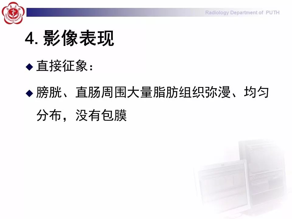 【病例】盆腔脂肪增多症1例CT影像表现