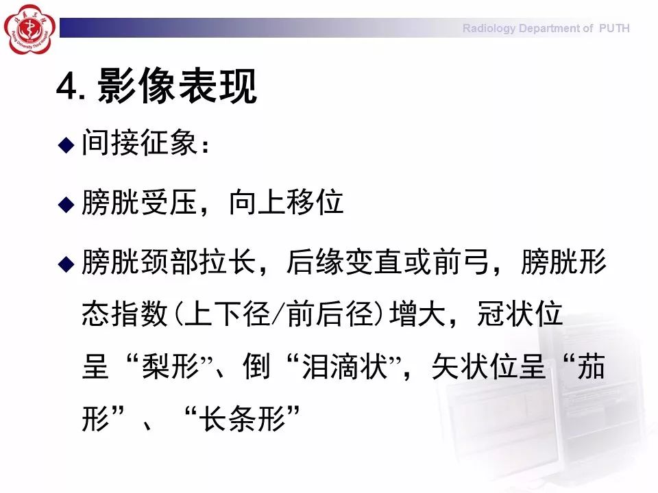 【病例】盆腔脂肪增多症1例CT影像表现
