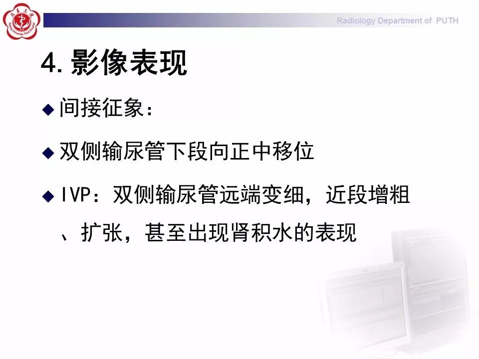【病例】盆腔脂肪增多症1例CT影像表现