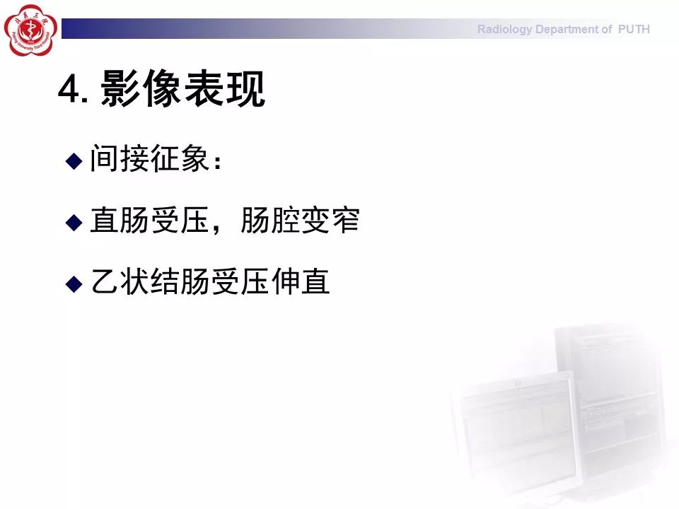 【病例】盆腔脂肪增多症1例CT影像表现