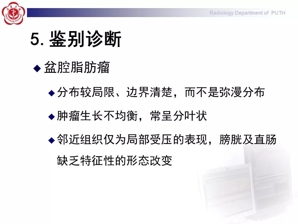 【病例】盆腔脂肪增多症1例CT影像表现