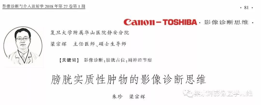 【病例】膀胱副神经节瘤1例CT影像表现