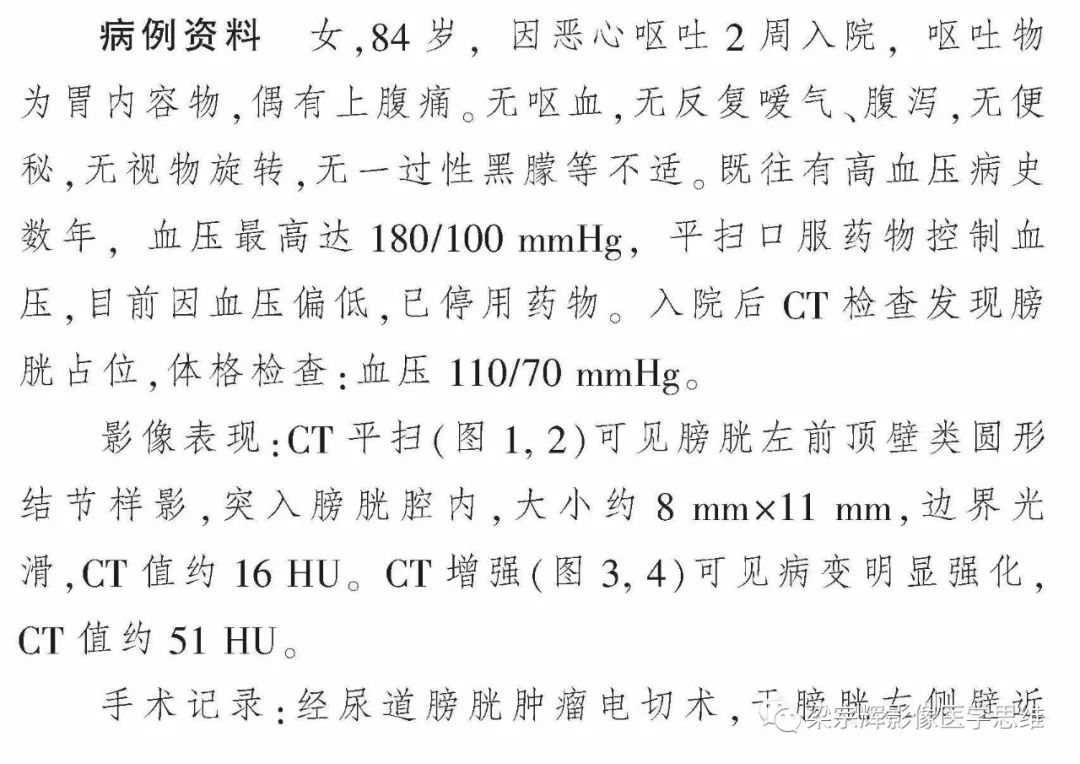【病例】膀胱副神经节瘤1例CT影像表现