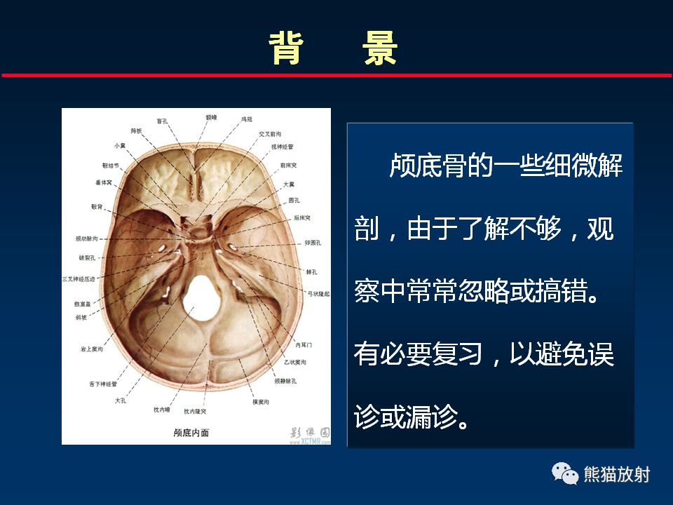 【PPT】颅底重要CT解剖及其临床意义