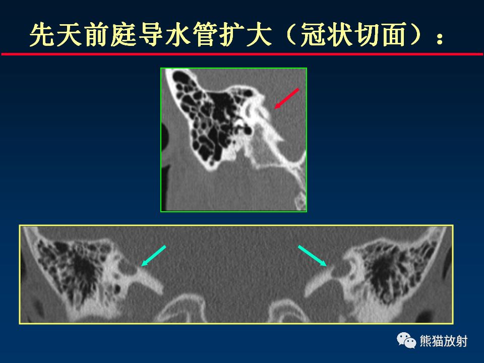 【PPT】颅底重要CT解剖及其临床意义