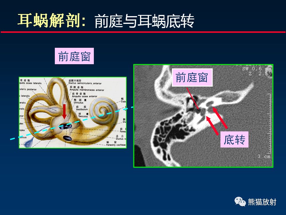【PPT】颅底重要CT解剖及其临床意义