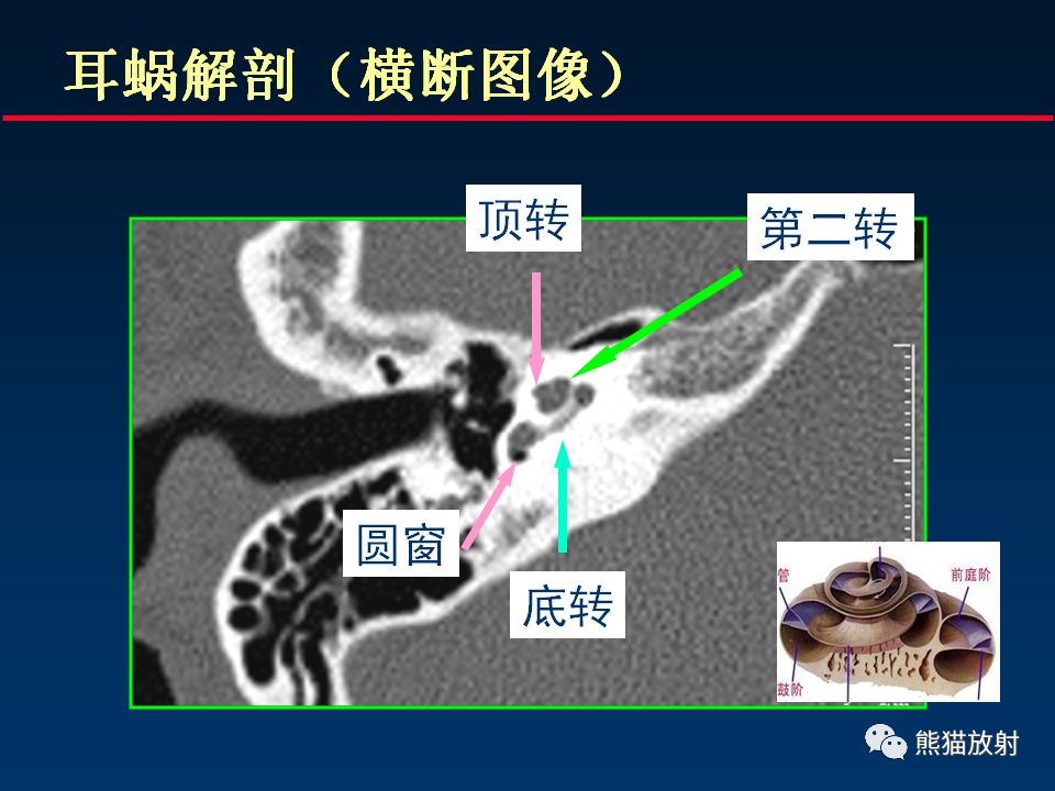 【PPT】颅底重要CT解剖及其临床意义