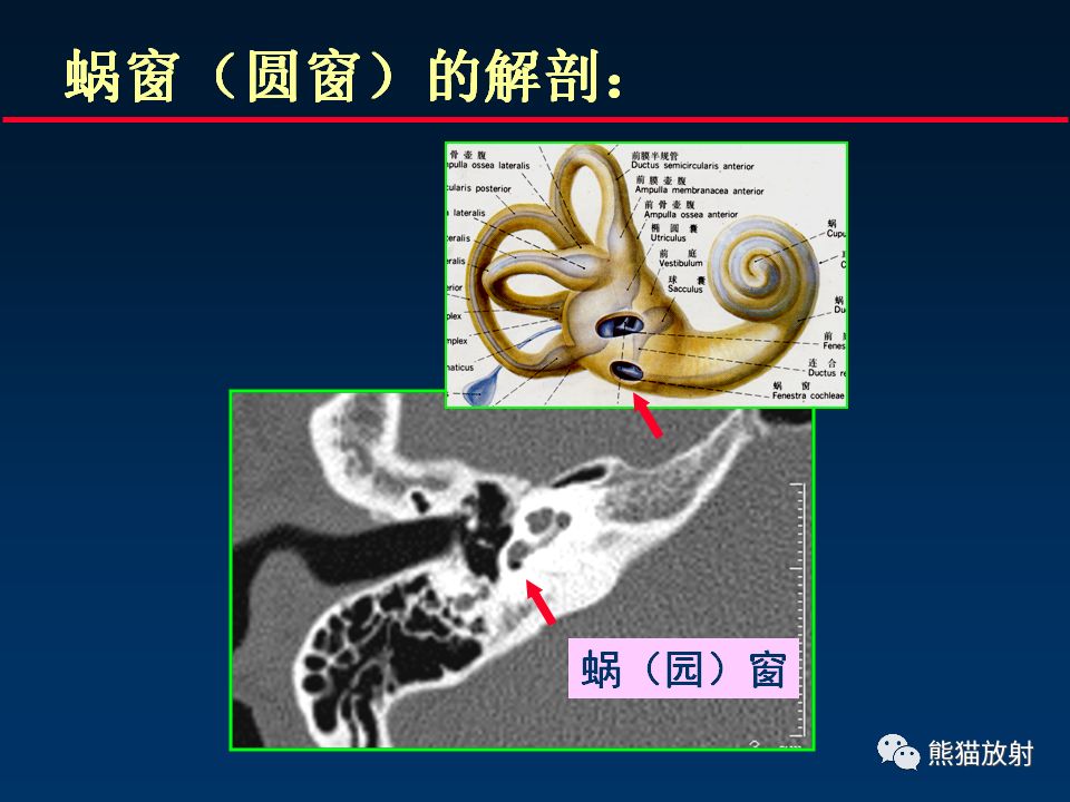 【PPT】颅底重要CT解剖及其临床意义