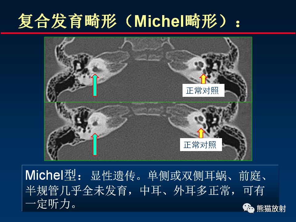 【PPT】颅底重要CT解剖及其临床意义