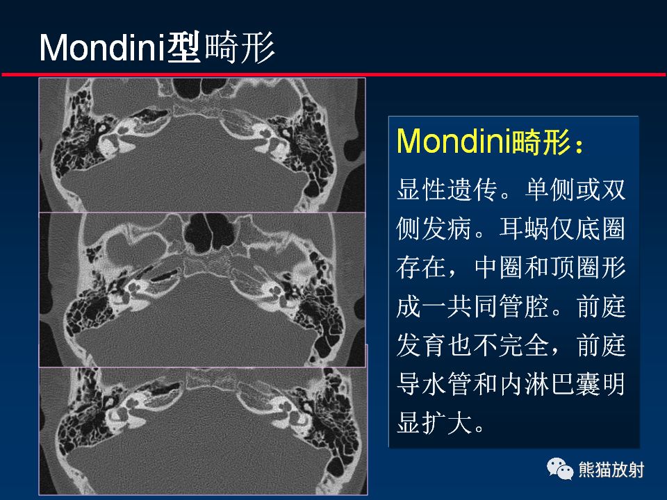 【PPT】颅底重要CT解剖及其临床意义