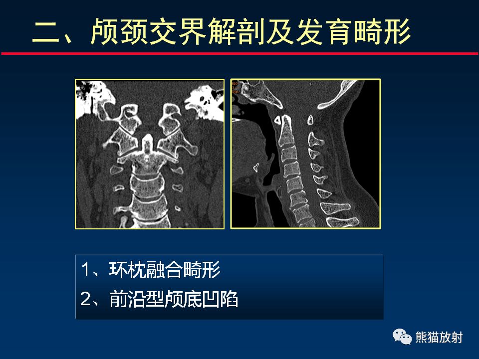 【PPT】颅底重要CT解剖及其临床意义