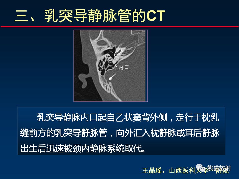 【PPT】颅底重要CT解剖及其临床意义
