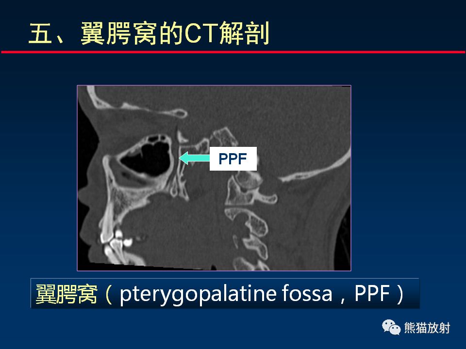 【PPT】颅底重要CT解剖及其临床意义