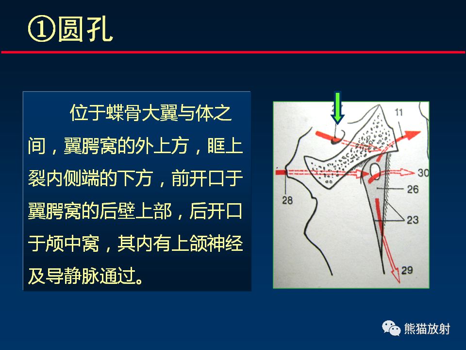 【PPT】颅底重要CT解剖及其临床意义
