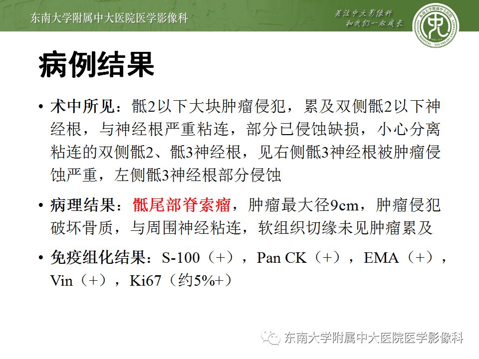 【病例】骶尾部脊索瘤1例CT及MR影像诊断