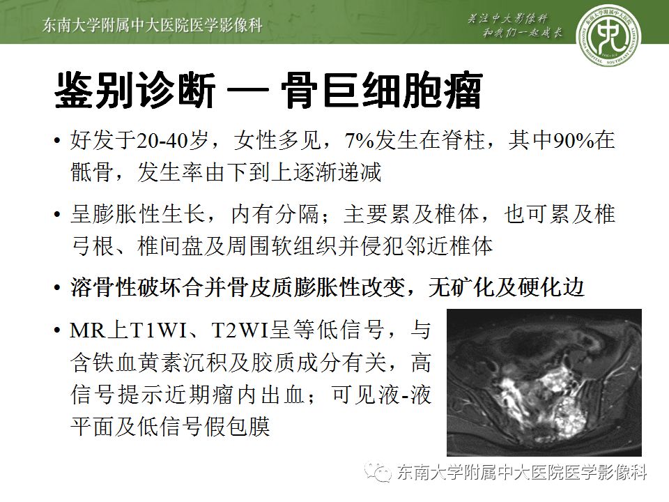 【病例】骶尾部脊索瘤1例CT及MR影像诊断