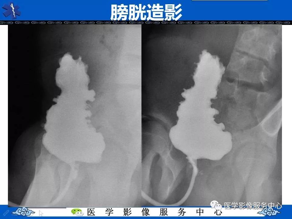 【PPT】圣诞树征