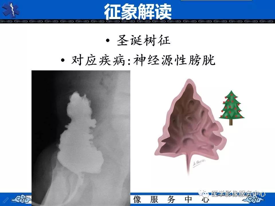 【PPT】圣诞树征