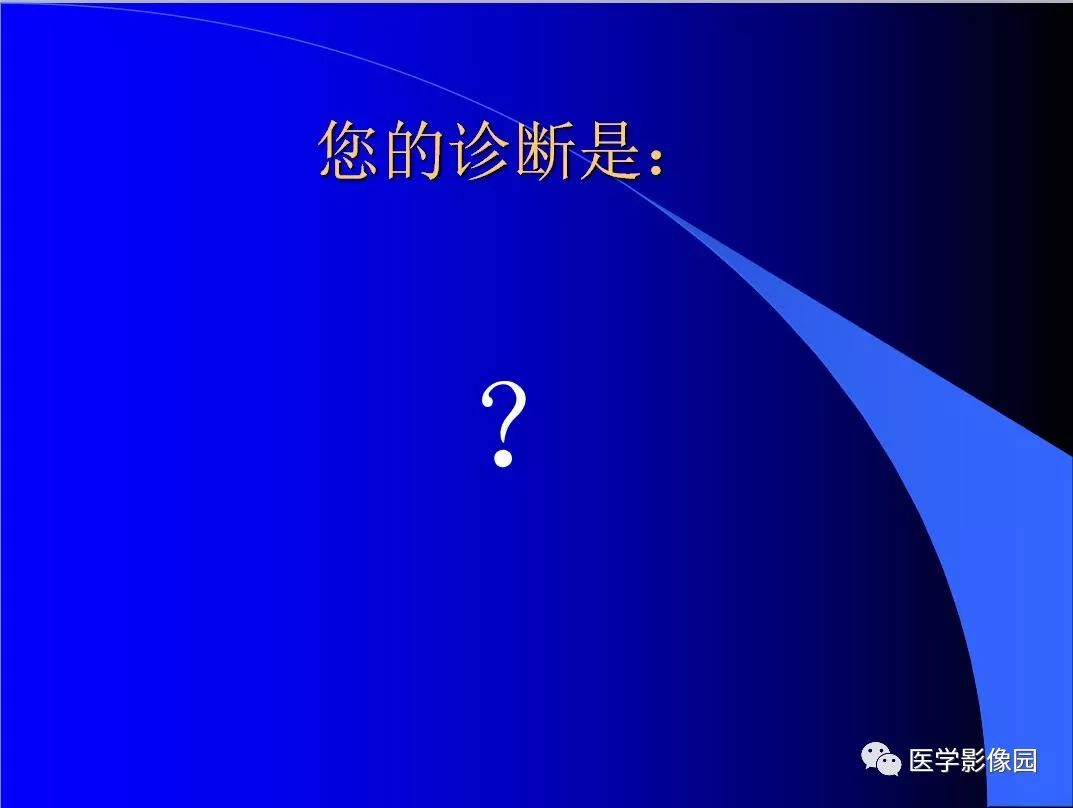 【病例】小肠粪石梗阻1例CT影像表现