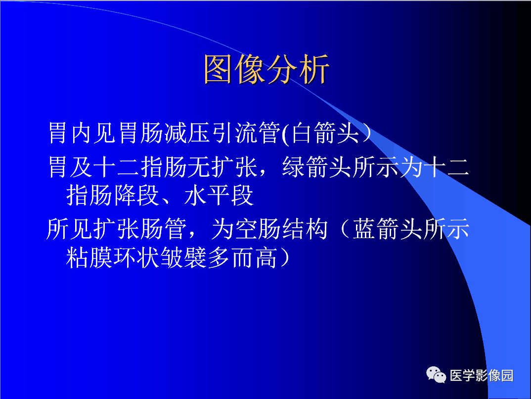 【病例】小肠粪石梗阻1例CT影像表现