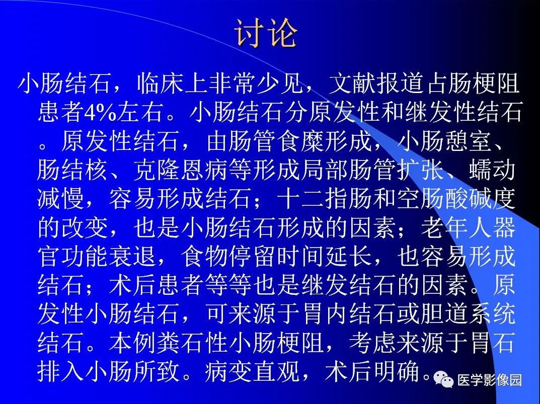 【病例】小肠粪石梗阻1例CT影像表现