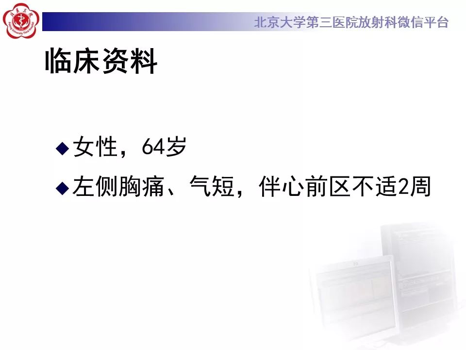 【病例】恶性胸膜间皮瘤1例CT影像诊断