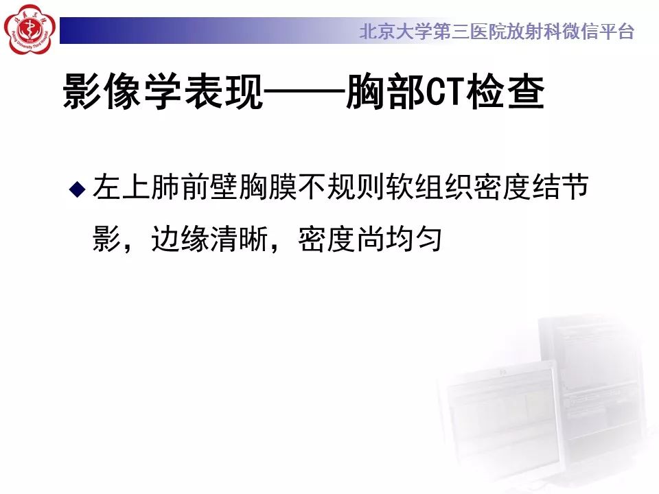 【病例】恶性胸膜间皮瘤1例CT影像诊断