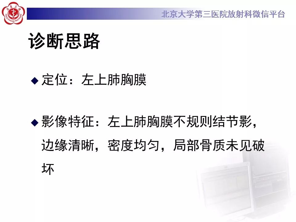 【病例】恶性胸膜间皮瘤1例CT影像诊断