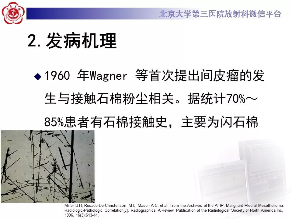【病例】恶性胸膜间皮瘤1例CT影像诊断