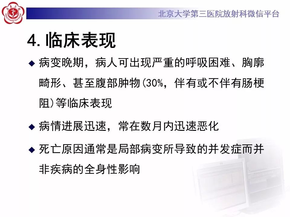 【病例】恶性胸膜间皮瘤1例CT影像诊断