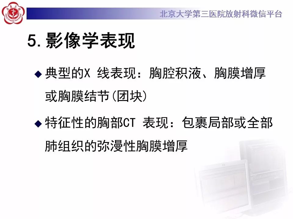 【病例】恶性胸膜间皮瘤1例CT影像诊断