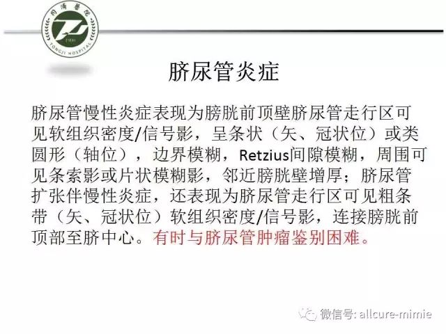 【PPT】正常脐尿管及脐尿管病变的影像学表现