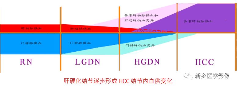 肝硬化磁共振影像表现 肝硬化磁共振影像表现