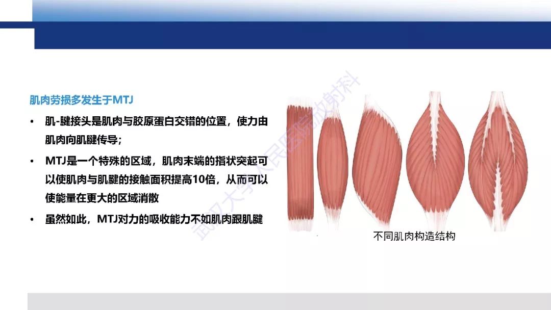 【PPT】肌肉创伤MR诊断：解剖、生物力学、病理生理学及影像学表现