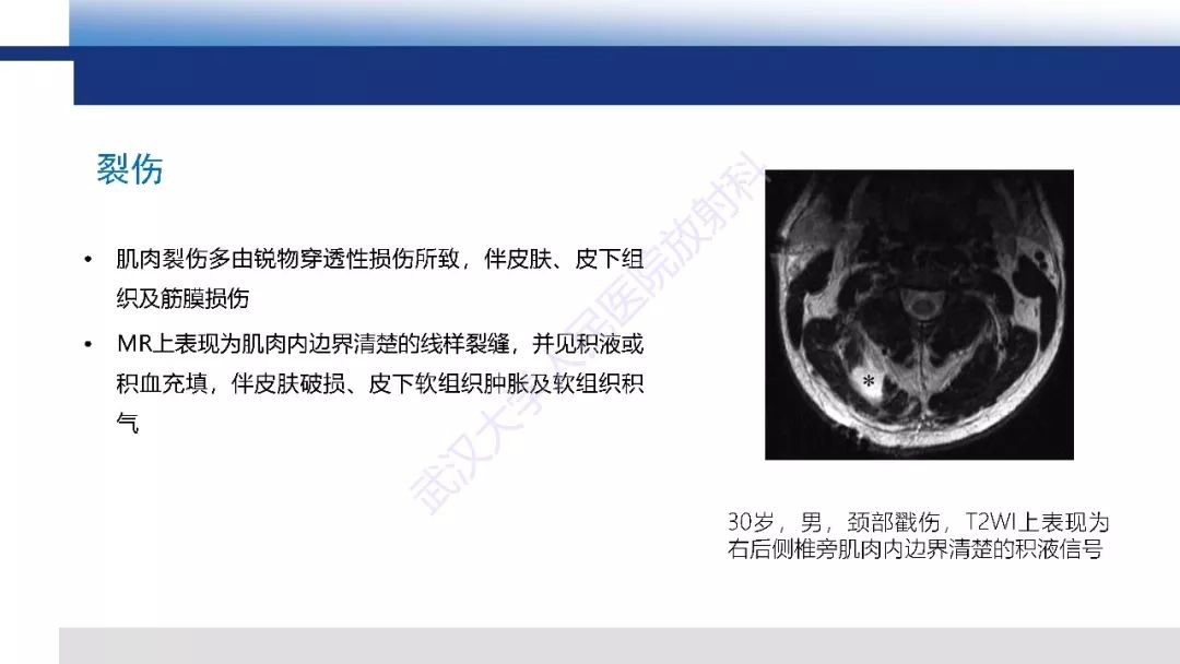 【PPT】肌肉创伤MR诊断：解剖、生物力学、病理生理学及影像学表现