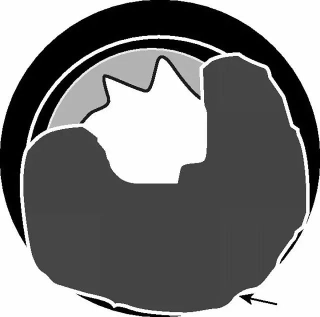 直肠癌MRl入门