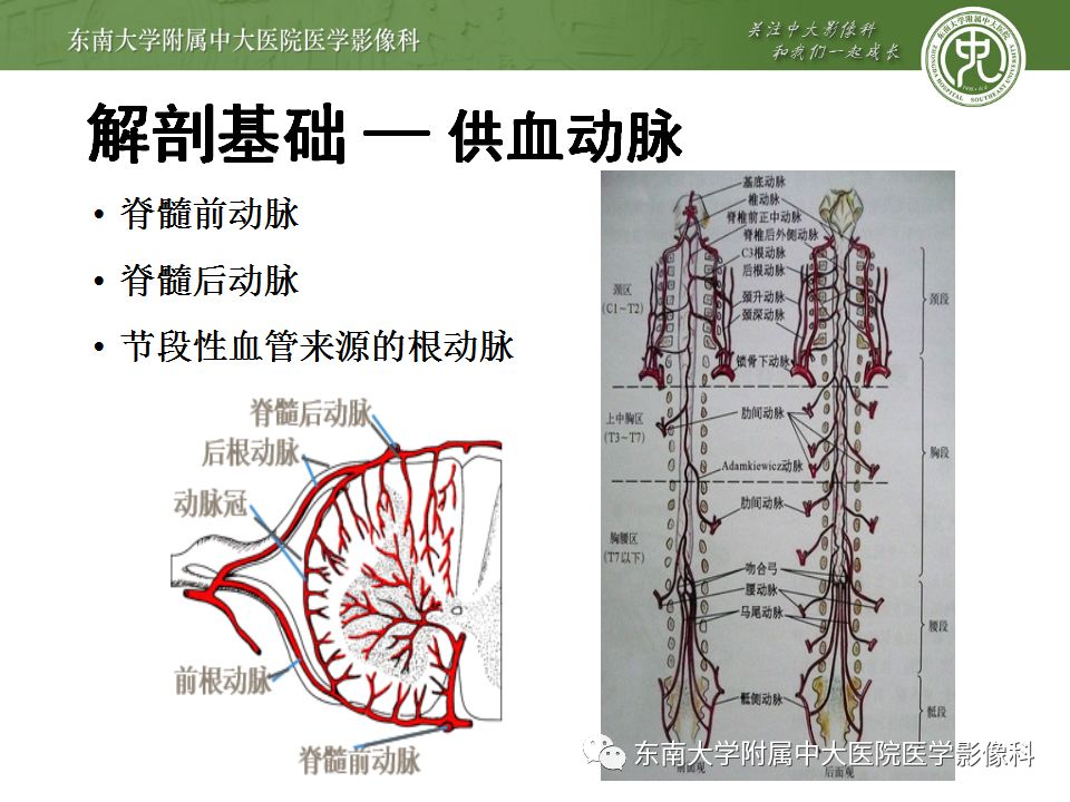 【病例】硬脊膜动静脉瘘1例MR影像诊断
