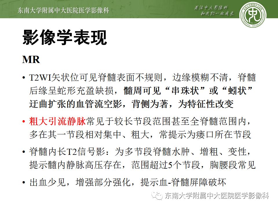 【病例】硬脊膜动静脉瘘1例MR影像诊断