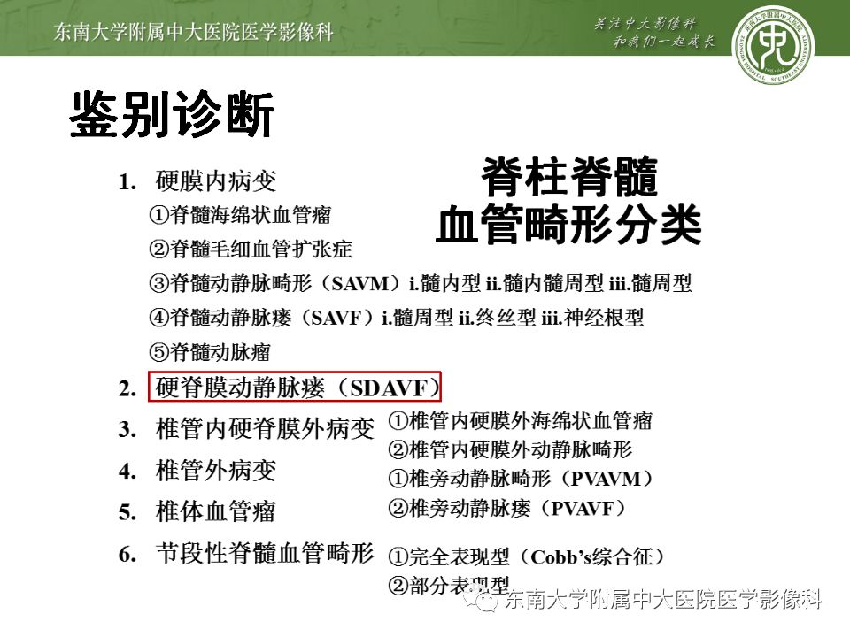 【病例】硬脊膜动静脉瘘1例MR影像诊断