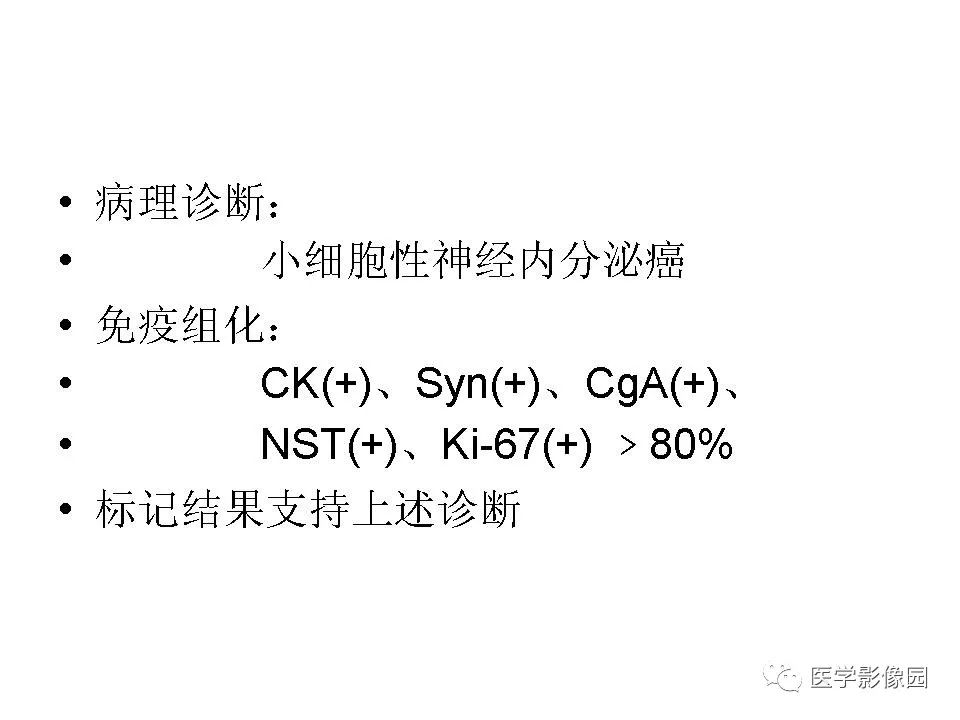 【病例】胰腺神经内分泌癌1例CT影像表现
