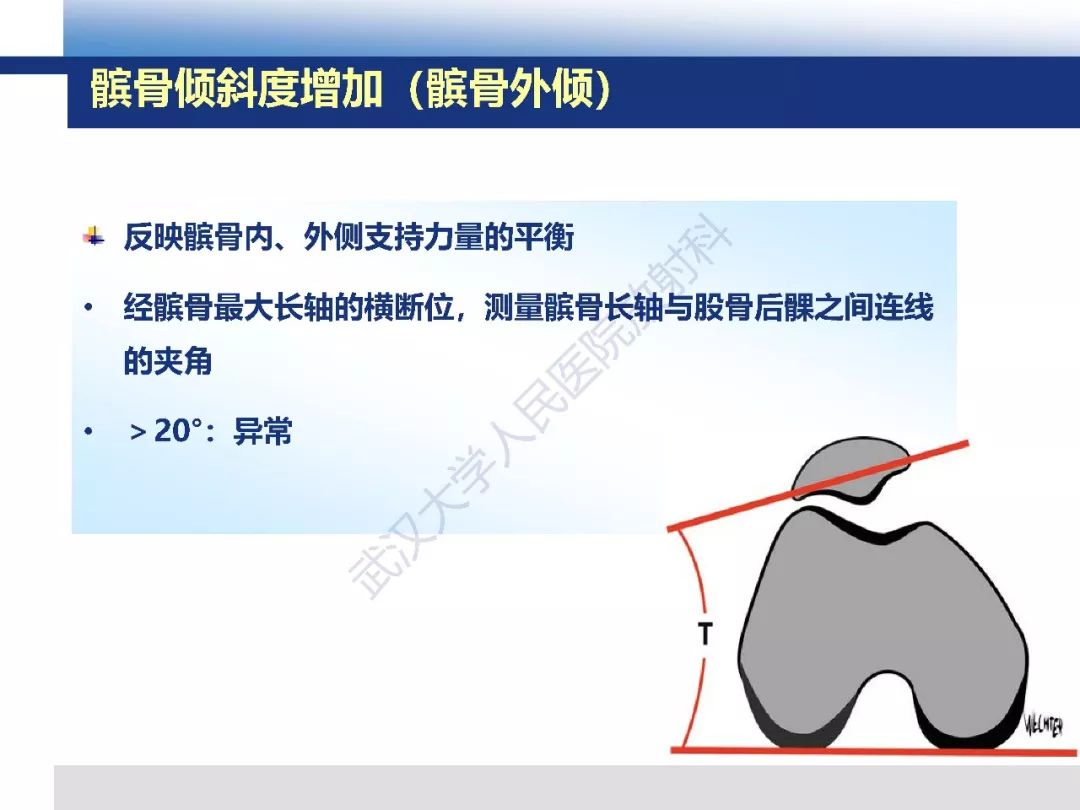 【PPT】髌骨不稳的影像学评价