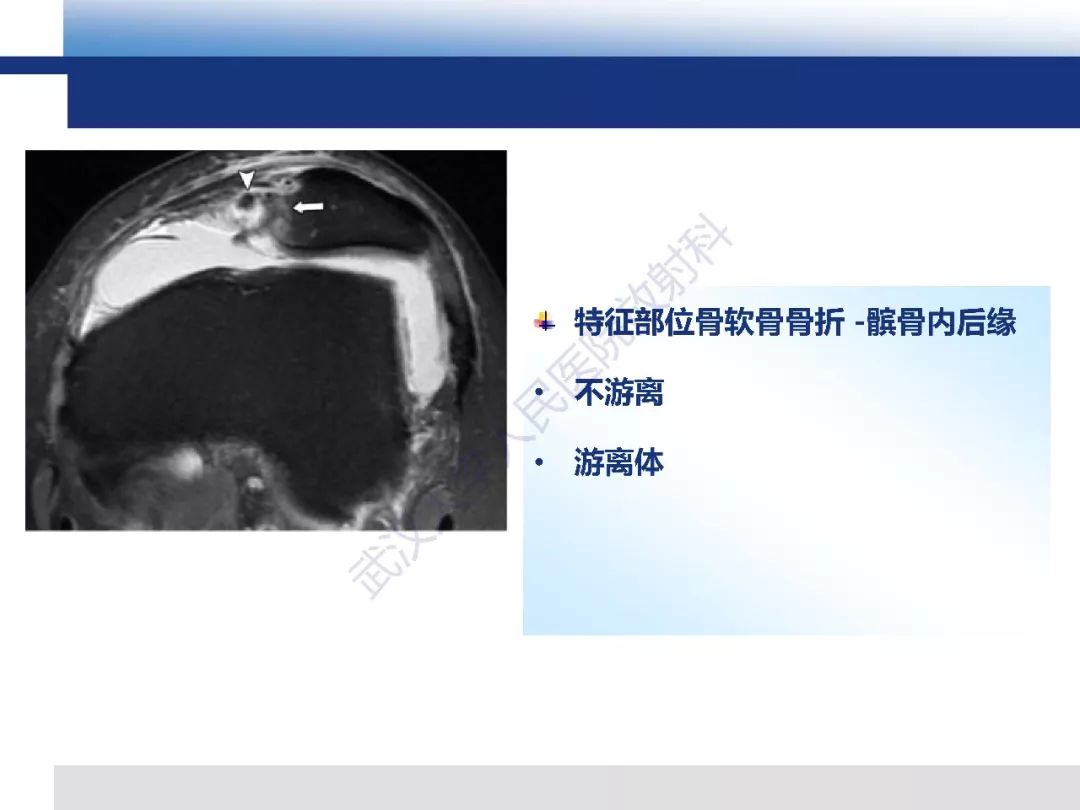 【PPT】髌骨不稳的影像学评价