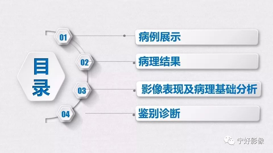 【PPT】肝脏血管平滑肌脂肪瘤影像表现及鉴别诊断 【PPT】肝脏血管平滑肌脂肪瘤影像表现及鉴别诊断