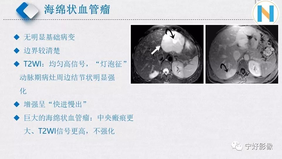 【PPT】肝脏血管平滑肌脂肪瘤影像表现及鉴别诊断 【PPT】肝脏血管平滑肌脂肪瘤影像表现及鉴别诊断