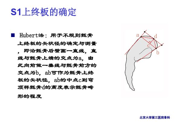 【PPT】腰椎滑脱的临床分型与影像学诊断