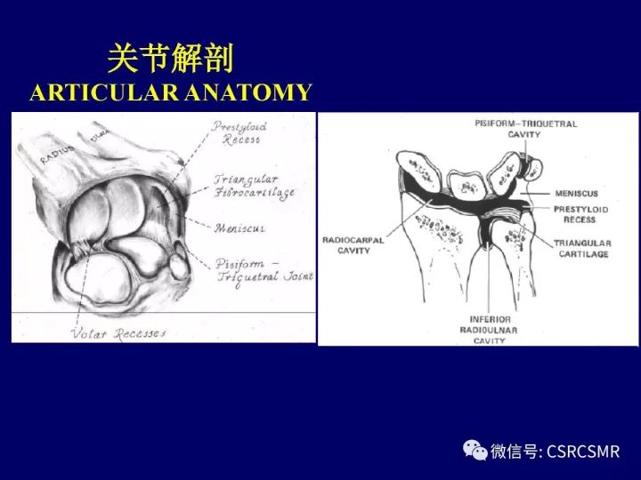 【PPT】腕关节韧带损伤的病理及影像学表现