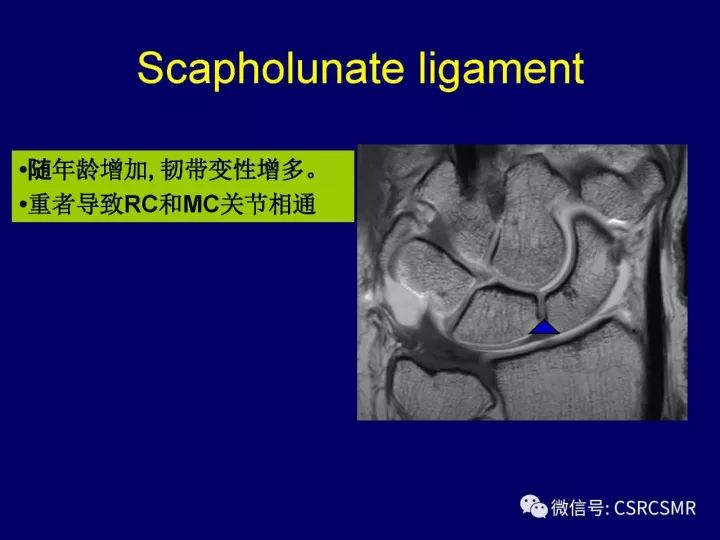 【PPT】腕关节韧带损伤的病理及影像学表现